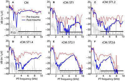 Using Cochlear Microphonic Potentials to Localize Peripheral Hearing Loss